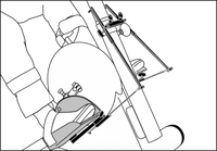 Ankle Joint Control With Bar Scale [Mo 534.000] - Think Mobility