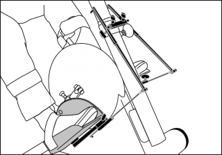 Ankle Joint Control With Bar Scale [Mo 534.000] - Think Mobility